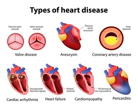 Cardiovascular Diseases Treatment and Medications